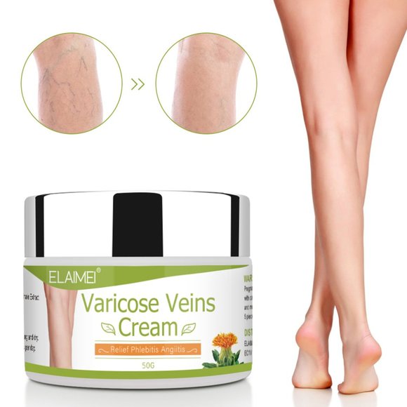 Varicose Veins Cream Relief Phlebitis Angiitis Inflammation Blood Vein - Picture 8 of 14